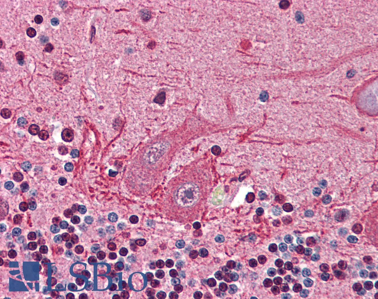 IHC-plus™ BMP2K / BIKE Antibody (N-Terminus)