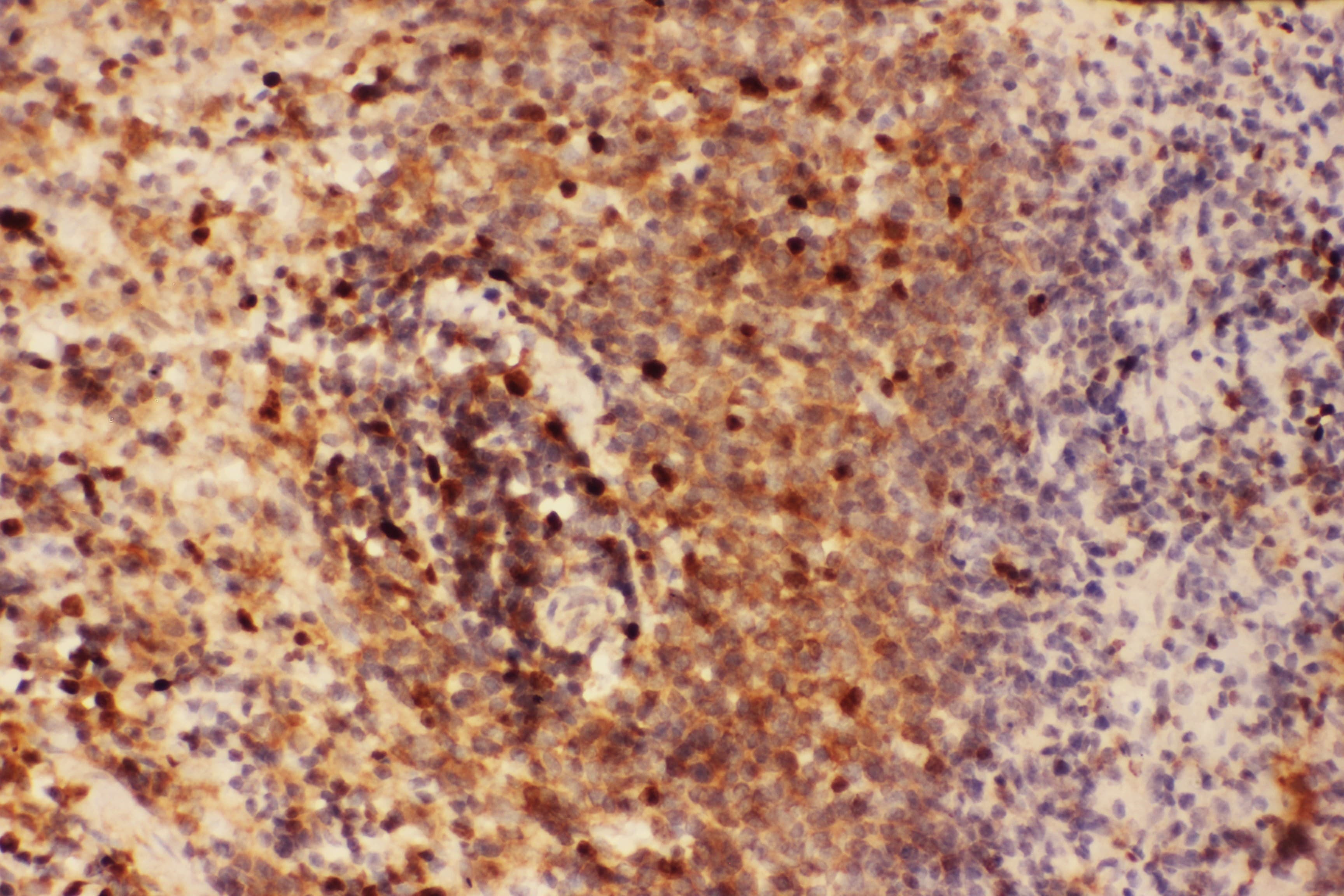 BECN1 / Beclin-1 Antibody (aa1-354)