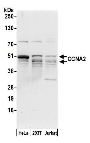 CCNA2 / Cyclin A2 Antibody (aa100-150)