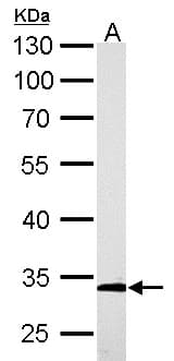 Polyclonal Rabbit anti-Human ARPC2 / p34-Arc Antibody (aa14-300, IHC, WB)