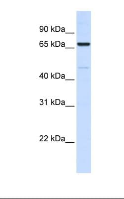 ACS5 / ACSL5 Antibody (aa470-519)