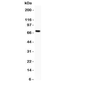 Polyclonal Rabbit anti-Human Estrogen Receptor Antibody (aa425-595, IHC, WB)