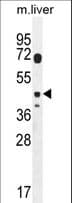 DTWD2 Antibody (aa109-138)