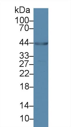 CARP / ANKRD1 Antibody (APC)