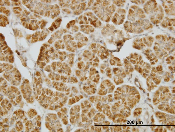 CENPJ / LAP Antibody (clone 5D5)