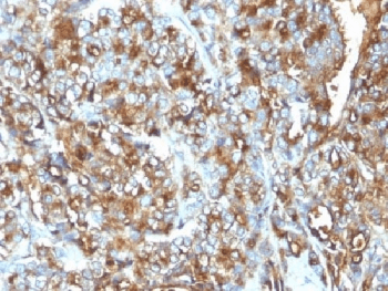 EMA / MUC1 Antibody (clone MUC1/520, Ready-to-Use)