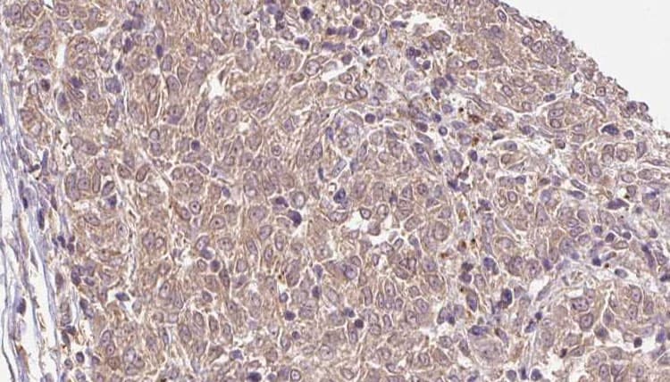 COL1A2 / Collagen I Alpha 2 Antibody