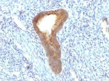 Alkaline Phosphatase Antibody (clone ALPL/597)