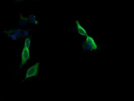 MAP2K1 / MKK1 / MEK1 Antibody (clone OTI1E5)