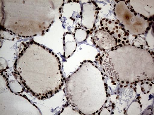 Monoclonal Mouse anti-Human SMC1A / SMC1 Antibody (clone OTI2D12, aa889-1016, IHC, WB)