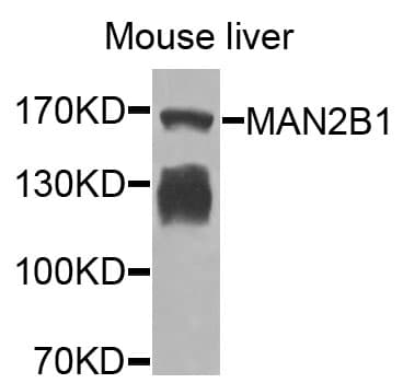 Polyclonal Rabbit anti-Human MAN2B1 / LAMAN Antibody (WB)