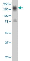 ITGA4 / VLA-4 / CD49d Antibody (clone 2C11)