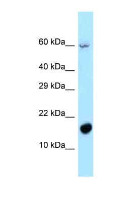 Polyclonal Rabbit anti-Human C5orf13 Antibody (aa13-62, WB)