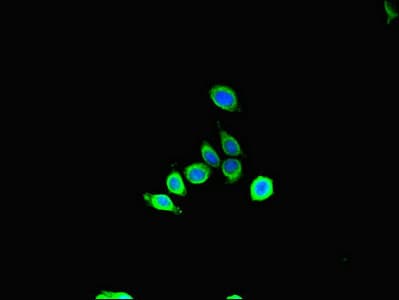 Polyclonal Rabbit anti-Human SBF2 Antibody (IHC, IF)