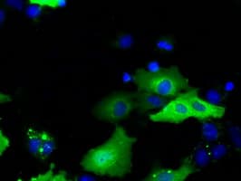 SNX9 / WISP Antibody (clone OTI1B5)