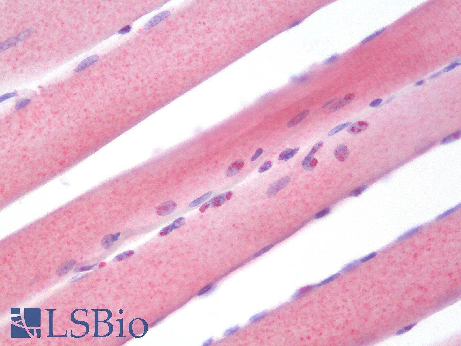 Polyclonal Rabbit anti-Human MYOD / MYOD1 Antibody (aa1-150, IF, WB)