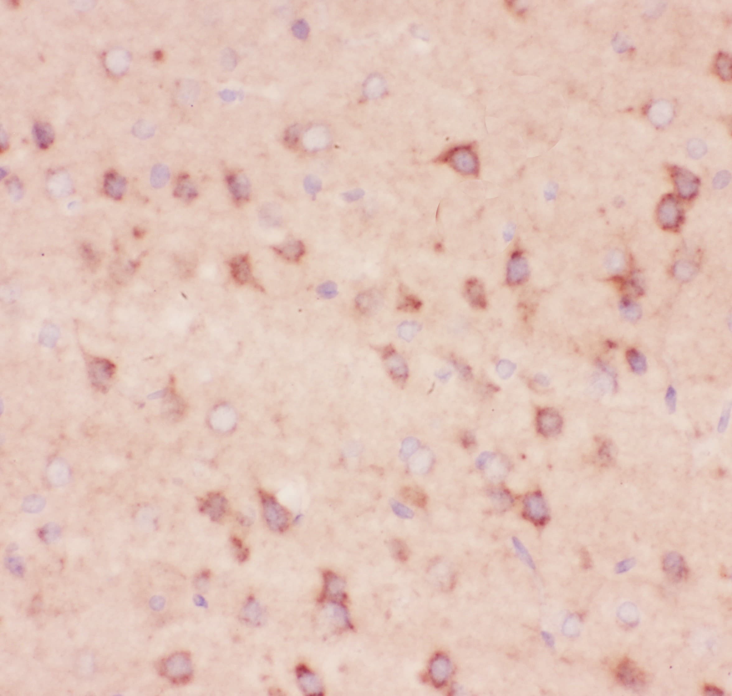 APP / Beta Amyloid Precursor Antibody (aa672-713)
