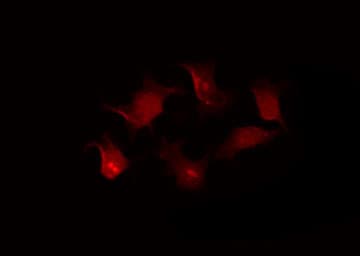 ERBB2 / HER2 Antibody (phospho-Tyr1248)