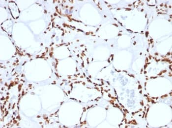 Histone H1 Antibody (clone SPM256)