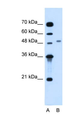 MGAT2 Antibody (aa201-250)