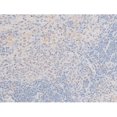 LIMK2 Antibody (phospho-Ser283)