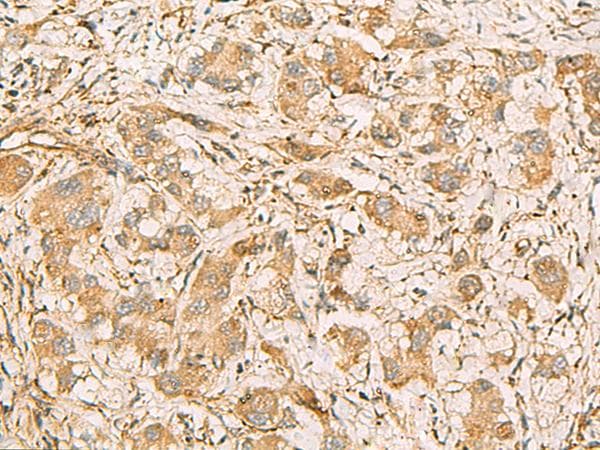 MRPS35 Antibody