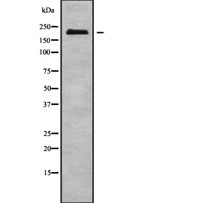 NUP210L Antibody
