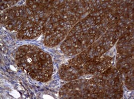 NME1 / NM23 Antibody (clone OTI1C11)