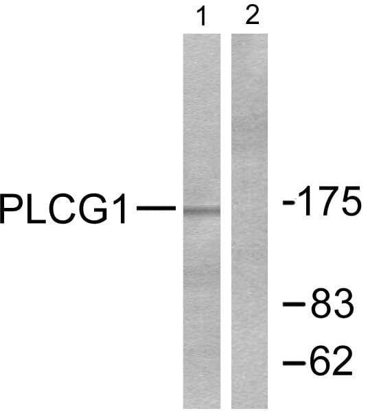 Polyclonal Rabbit anti-Human PLCG1 Antibody (p771, IHC, WB)