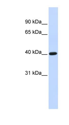 Polyclonal Rabbit anti-Human TFB1M Antibody (aa36-85, WB)