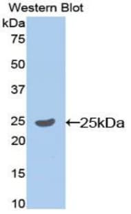 SELP / P-Selectin / CD62P Antibody (aa58-259, Cy3)