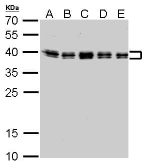 HNRNPC / HNRNP C Antibody (aa1-142)