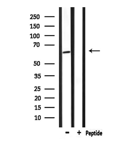 NR4A1 / NUR77 Antibody