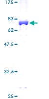 Human PGK2 Protein (Recombinant GST)