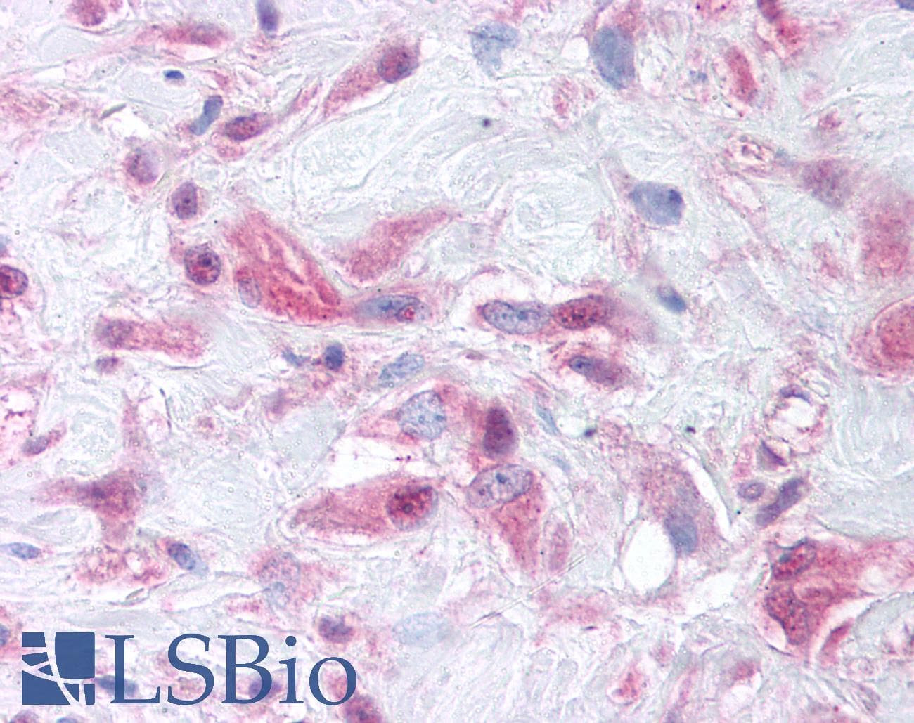 IHC-plus™ Polyclonal Rabbit anti-Human MMP9 / Gelatinase B Antibody (Internal, IHC)