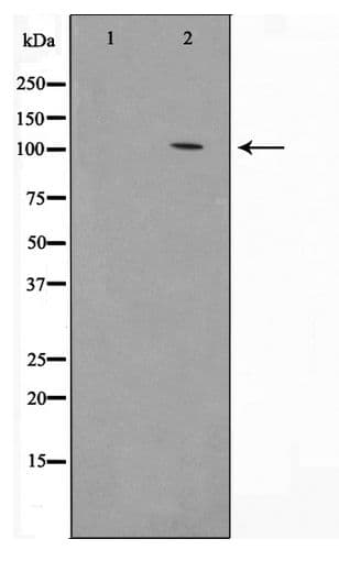HSPH1 / HSP105 Antibody