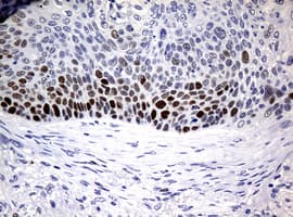 PCNA Antibody (clone OTI8C12)