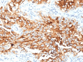 Monoclonal Mouse anti-Human MSLN / Mesothelin Antibody (clone MSLN/2131, IHC)