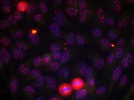 ELK1 Antibody (phospho-Thr417)