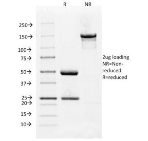 FLT1 / VEGFR1 Antibody (clone FLT1/658)
