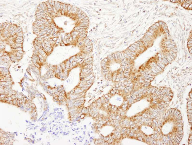Polyclonal Rabbit anti-Human AKAP1 / AKAP Antibody (aa375-425, IHC, IF)