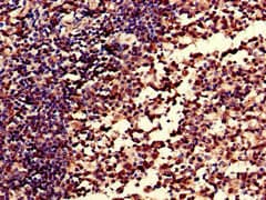 CR1 / CD35 Antibody (aa901-1095)