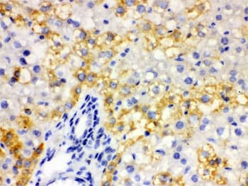 Polyclonal Rabbit anti-Human ALDH2 Antibody (IHC, WB)