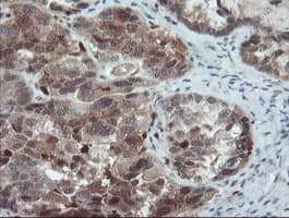 PYCARD / ASC / TMS1 Antibody (clone OTI3E9, Carrier-free)