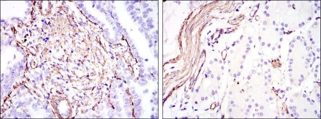 ACTA2 / Smooth Muscle Actin Antibody (clone 4F4)