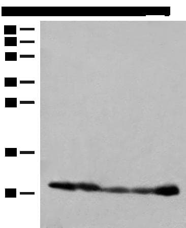 Polyclonal Rabbit anti-Human ATP5I Antibody (IHC, WB)