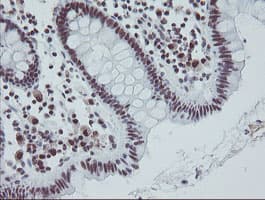Monoclonal Mouse anti-Human TPRKB Antibody (clone OTI1E9, IHC, WB)