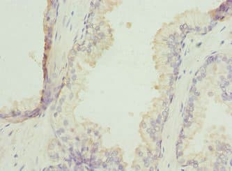 Polyclonal Rabbit anti-Human ZNF350 Antibody (IHC)