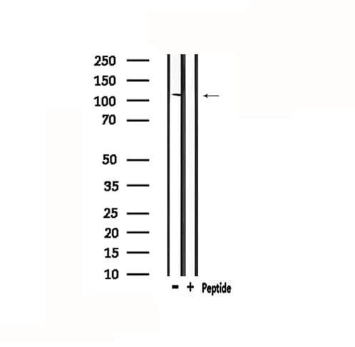 DSG1 / Desmoglein 1 Antibody