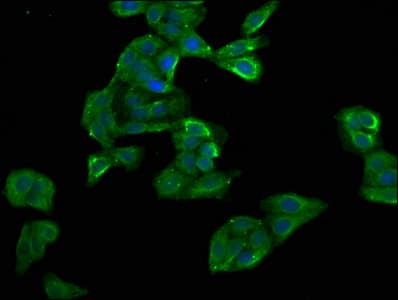 Polyclonal Rabbit anti-Human MYD118 / GADD45B Antibody (IHC, IF)